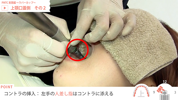 PMTC 実践編 ～ラバーカップ～ 08. 上顎口蓋側　その２