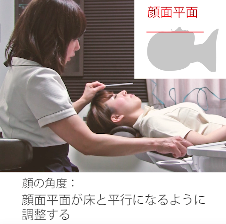 ポジショニング 02. 患者ポジション