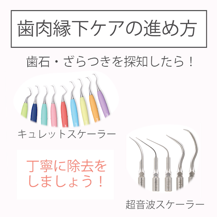 メインテナンスの流れ 14. プロフェッショナルケアその２