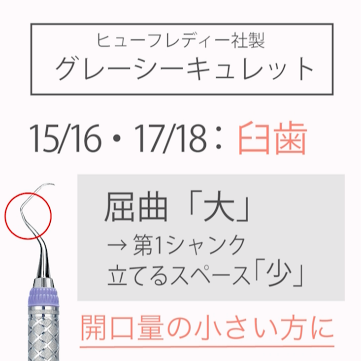 苦手をなくそうSRP 基礎編 02. キュレットを理解しよう その２