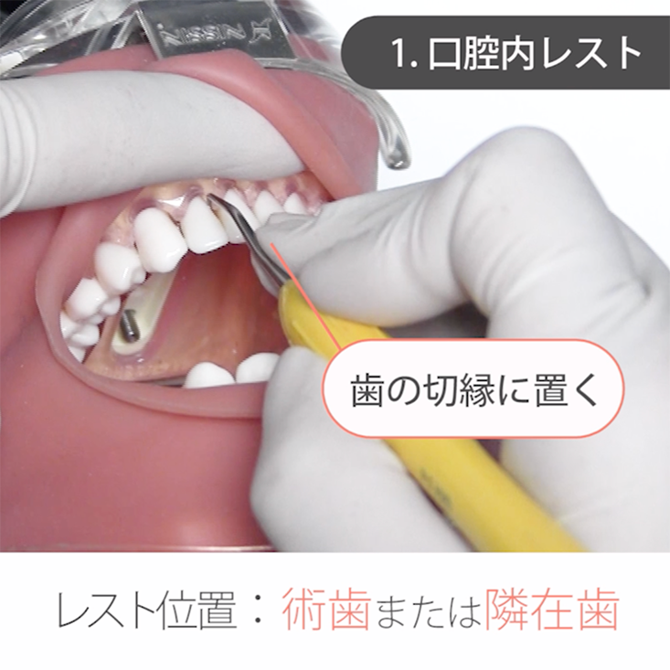苦手をなくそうSRP 基礎編 08. 固定の取り方 その１