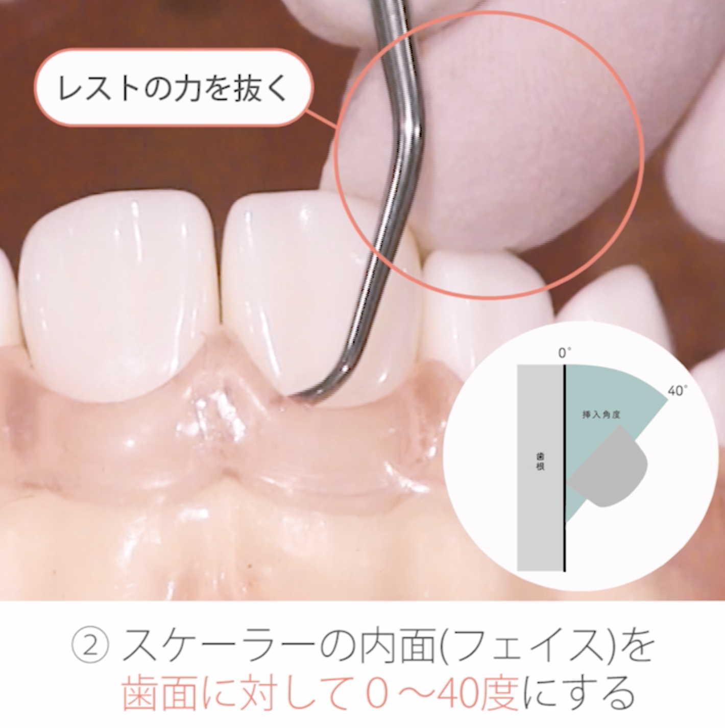 苦手をなくそうSRP 基礎編 10. カッティングエッジの適合