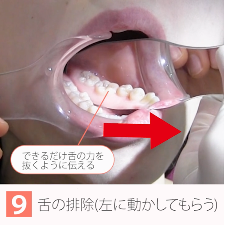座位で撮る口腔内写真12枚法 10. 下顎舌側面観の手順 その２
