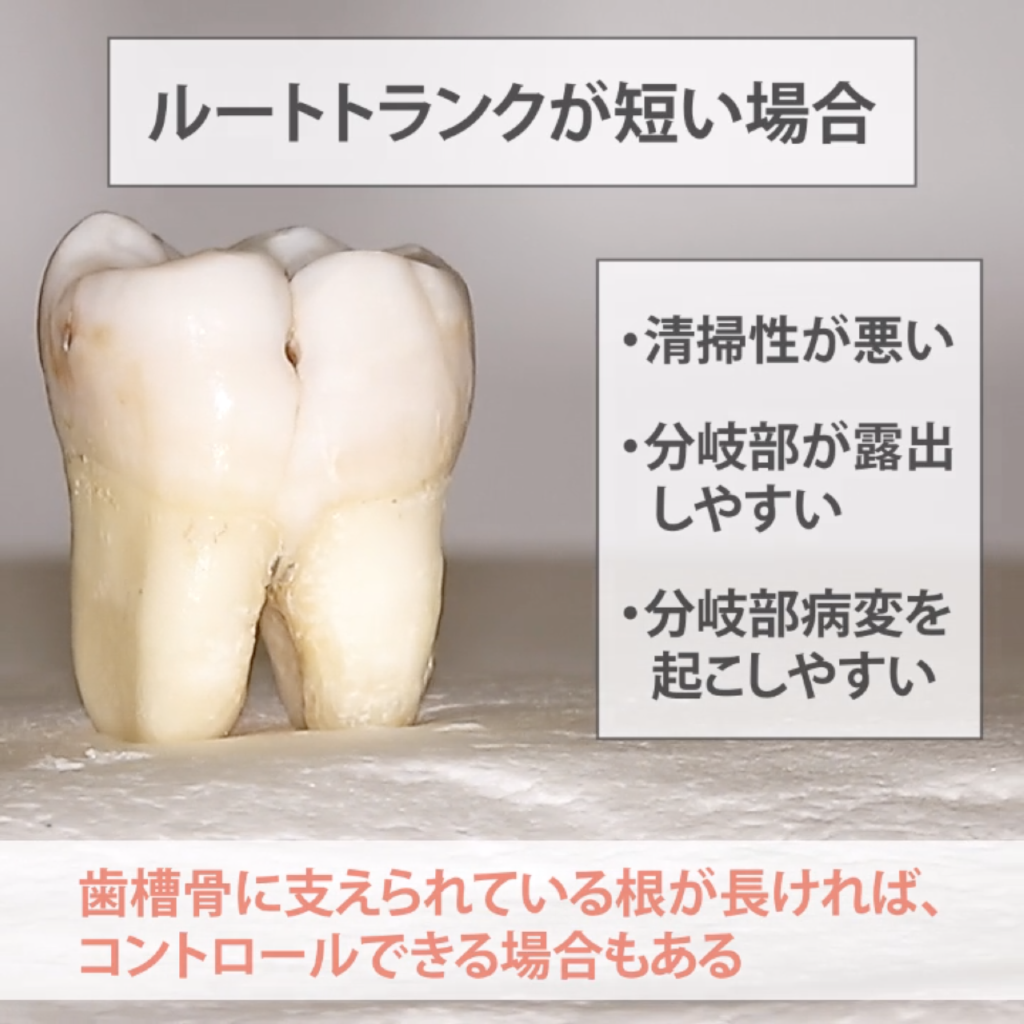 01.ルートトランク