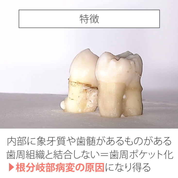 やさしい解剖学 03.エナメルパール