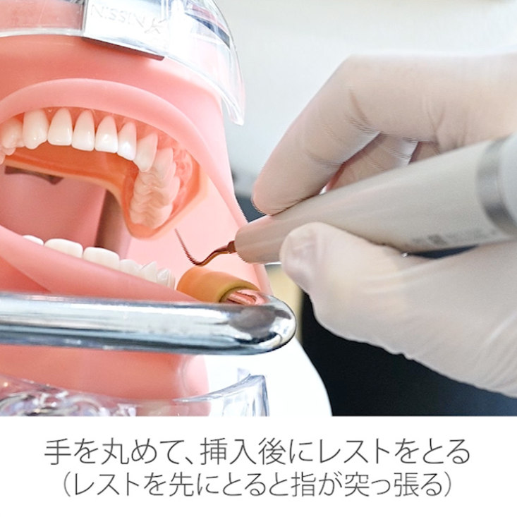 スケーリング実践編 リニューアル版 04.右下臼歯部頬側・舌側その1
