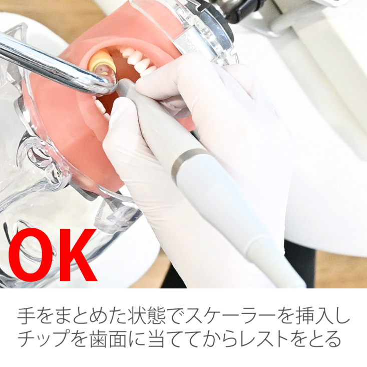 スケーリング実践編 リニューアル版 07.左上口蓋側その1