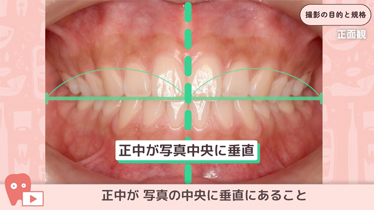 01.撮影の目的と規格