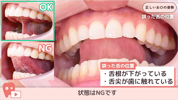 01.正しいお口の姿勢