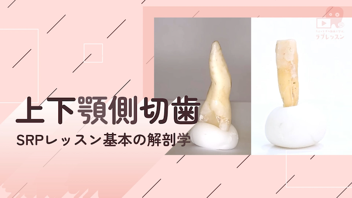 ☆SRPレッスン 基本の解剖学 ☆05.上下顎側切歯