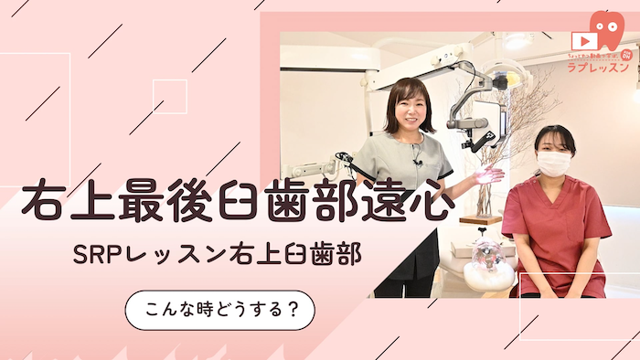 ☆SRPレッスン 右上臼歯部 ☆23.こんな時どうする？-右上最後臼歯部遠心-