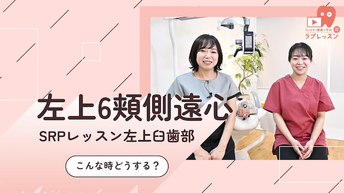 ☆SRPレッスン 左上臼歯部 ☆11.こんな時どうする？-左上6_頬側/遠心-