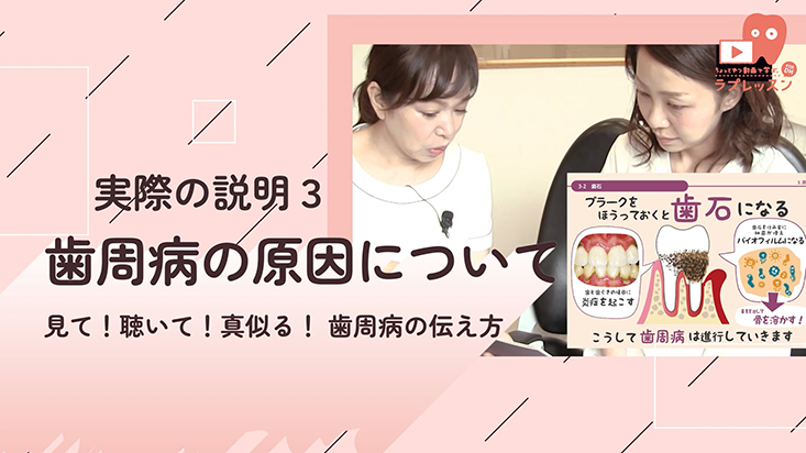 03.実際の説明3 歯周病の原因について