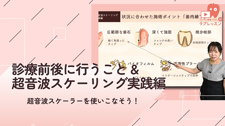 ☆超音波スケーラーを使いこなそう！ ☆03.診療前後に行うこと&超音波スケーリング実践編