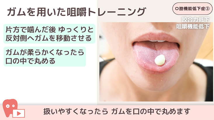 口腔機能低下症 03.咬合力低下・咀嚼機能低下への対応 -ガム咀嚼トレーニングなど-　