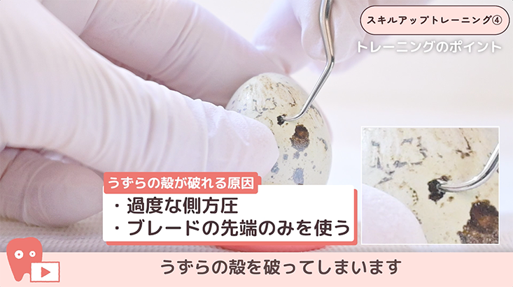 04.SRPトレーニング -うずらの卵で親指側方圧トレーニング-