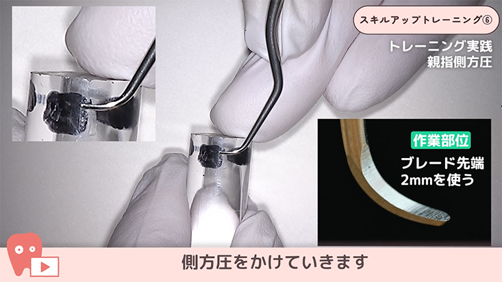 06.SRPトレーニング-アクリルスティックで親指側方圧トレーニング-