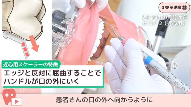 24.キュレットスケーラーの見分け方