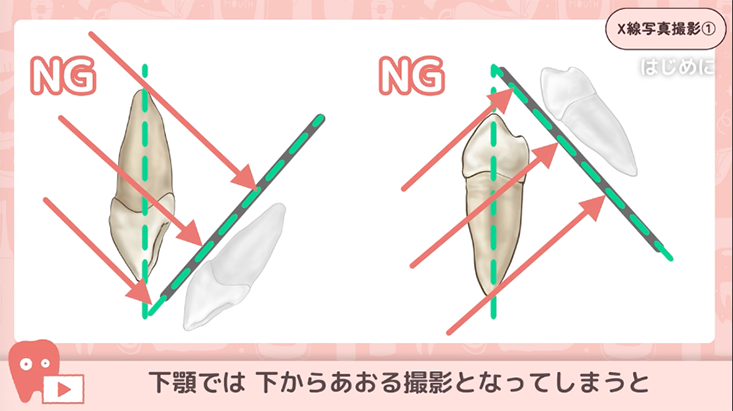 01.デンタルX線撮影方法の基礎知識と一連の流れ