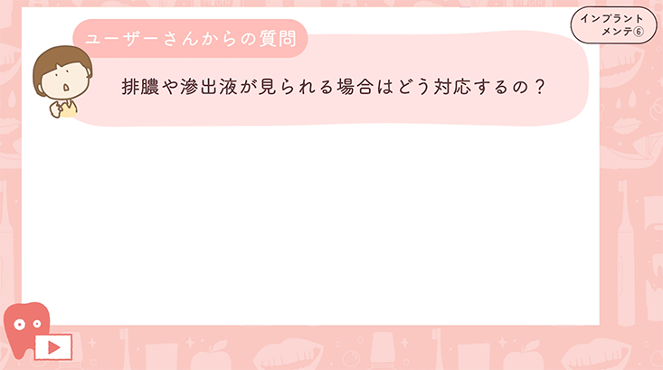06.メインテナンス 診査編 ①-プラークコントロール・周囲粘膜の診査-
