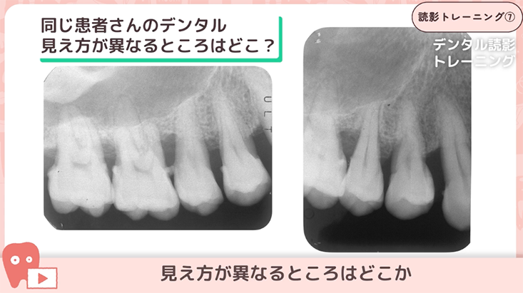 08.撮影角度による見え方の違い②