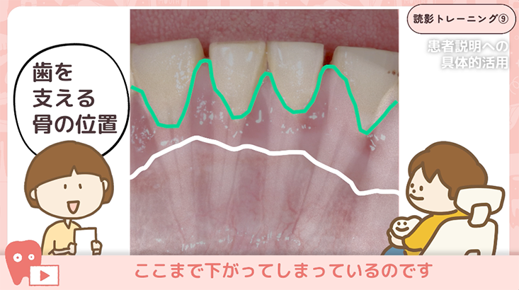 09.デンタルの活用