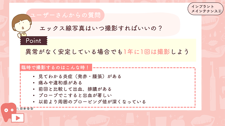 インプラントメインテナンス"